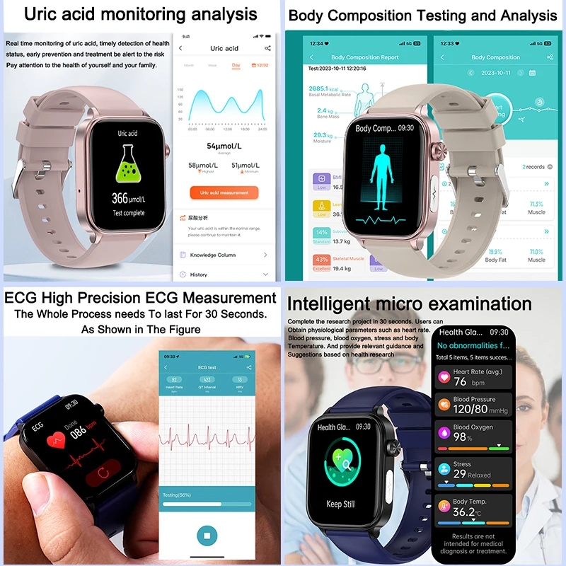 2025 Yeni XIAOM1 EKG+PPG Kan Y - Smartwatch New Watches 2025 incelemesi ve fiyatı